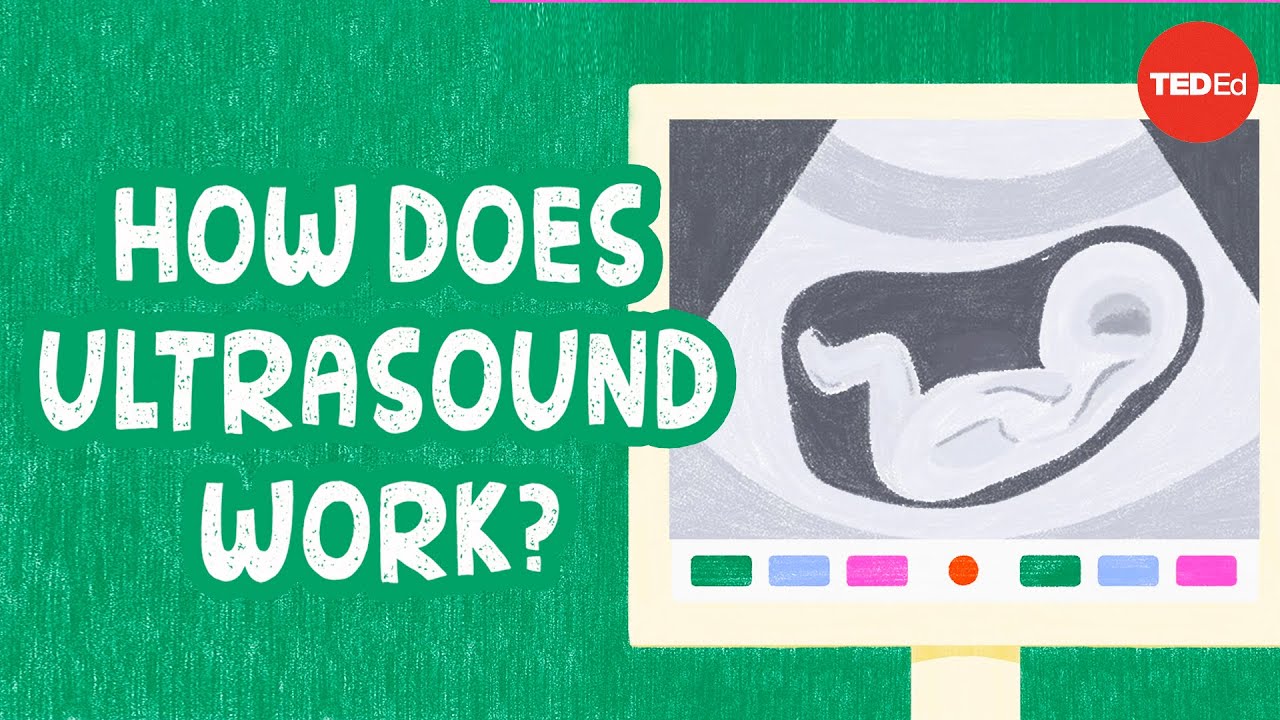 How ultrasound works